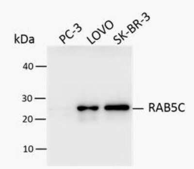 Western Blot: RAB5C Antibody [NBP1-80858] - Human cancer cell line lysates PC-3, LOVO and SK-BR-3. Image from verified customer review.