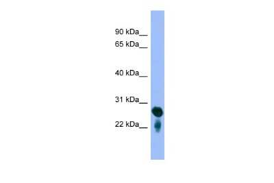 Western Blot: RAB5C Antibody [NBP2-88115] - WB Suggested Anti-RAB5C Antibody Titration: 0.2-1 ug/ml. ELISA Titer: 1:1562500. Positive Control: Human brain