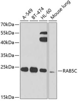 Western Blot RAB5C Antibody - BSA Free