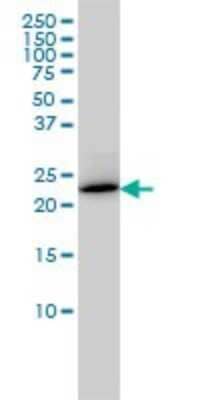 Western Blot: RAB6A Antibody (3G3) [H00005870-M01] - RAB6A monoclonal antibody (M01), clone 3G3 Analysis of RAB6A expression in HL-60.