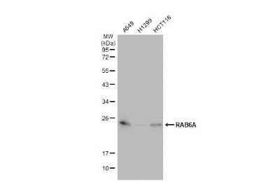 Western Blot: RAB6A Antibody (HL1047) [NBP3-13701] - Various whole cell extracts (30 ug) were separated by 12% SDS-PAGE, and the membrane was blotted with RAB6A antibody [HL1047] (NBP3-13701) diluted at 1:1000. The HRP-conjugated anti-rabbit IgG antibody (NBP2-19301) was used to detect the primary antibody.