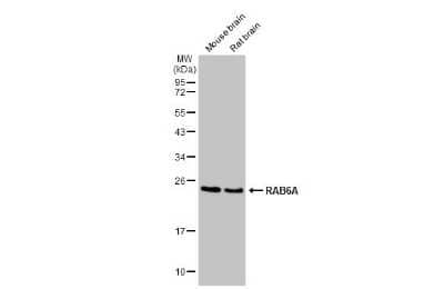 Western Blot: RAB6A Antibody (HL1047) [NBP3-13701] - Various tissue extracts (50 ug) were separated by 12% SDS-PAGE, and the membrane was blotted with RAB6A antibody [HL1047] (NBP3-13701) diluted at 1:1000. The HRP-conjugated anti-rabbit IgG antibody (NBP2-19301) was used to detect the primary antibody.