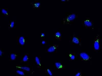 Immunocytochemistry/Immunofluorescence: RAB6A Antibody [NBP2-97111] - Immunofluorescence staining of RAB6A in HeLa cells. Cells were fixed with 4% PFA, permeabilzed with 0.3% Triton X-100 in PBS, blocked with 10% serum, and incubated with rabbit anti-human RAB6A polyclonal antibody (1:1000) at 4C overnight. Then cells were stained with the Alexa Fluor(R)488-conjugated Goat Anti-rabbit IgG Secondary antibody (green) and counterstained with DAPI (blue). Positive staining was localized to cytoplasm.