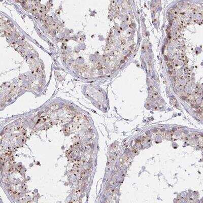 Immunohistochemistry-Paraffin: RAB6A Antibody [NBP2-32386] - Staining of human testis shows strong cytoplasmic positivity, with a dot like pattern in cells in seminiferus ducts.