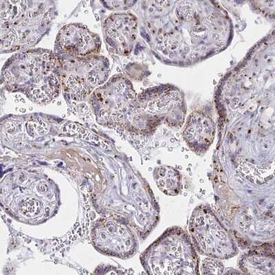 Immunohistochemistry-Paraffin: RAB6A Antibody [NBP2-32386] - Staining of human Placenta shows strong granular cytoplasmic positivity in trophoblastic cells.