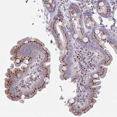 Immunohistochemistry-Paraffin: RAB6A Antibody [NBP2-32386] - Staining of human Small intestine shows strong granular cytoplasmic  positivity in glandular cells.