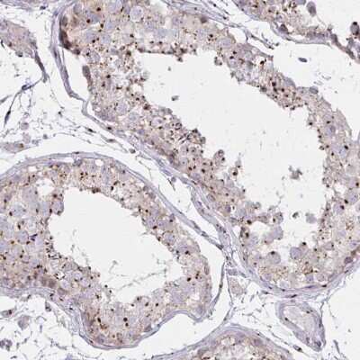 Immunohistochemistry-Paraffin: RAB6A Antibody [NBP2-32386] - Staining of human Testis shows strong granular cytoplasmic positivity in cells in seminiferous ducts.