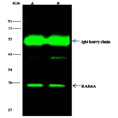 Immunoprecipitation: RAB6A Antibody [NBP2-97111] - RAB6A was immunoprecipitated using: Lane A: 0.5 mg 293T Whole Cell Lysate. Lane B: 0.5 mg HL-60 Whole Cell Lysate. 4 ul anti-RAB6A rabbit polyclonal antibody and 15 ul of 50 % Protein G agarose. Primary antibody: Anti-RAB6A rabbit polyclonal antibody, at 1:100 dilution. Secondary antibody: Dylight 800-labeled antibody to rabbit IgG (H+L), at 1:5000 dilution. Developed using the Odyssey technique. Performed under reducing conditions. Predicted band size: 24 kDa. Observed band size: 24 kDa