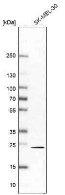 Western Blot: RAB6A Antibody [NBP2-32386] - Analysis in human cell line SK-MEL-30.