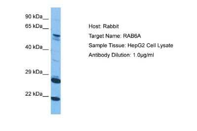 Western Blot: RAB6A Antibody [NBP2-88116] - Host: Rabbit. Target Name: RAB6A. Sample Tissue: Human HepG2 Whole Cell. Antibody Dilution: 1.0ug/ml