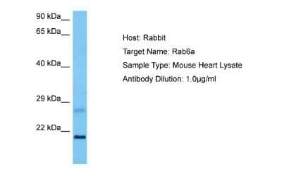 Western Blot: RAB6A Antibody [NBP2-88116] - Host: Mouse. Target Name: RAB6A. Sample Tissue: Mouse Heart. Antibody Dilution: 1ug/ml