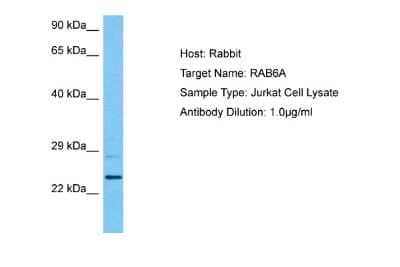 Western Blot: RAB6A Antibody [NBP2-88117] - Host: Rabbit. Target Name: RAB6A. Sample Tissue: Human Jurkat Whole Cell lysates. Antibody Dilution: 1ug/ml