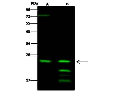 Western Blot: RAB6A Antibody [NBP2-97111] - Anti-RAB6A rabbit polyclonal antibody at 1:500 dilution. Lane A: NCI-H1299 Whole Cell Lysate. Lane B: HL60 Whole Cell Lysate. Lysates/proteins at 30 ug per lane. Secondary Goat Anti- Rabbit  IgG H&L (Dylight 800)  at 1/10000 dilution. Developed using the Odyssey technique. Performed under reducing conditions. Predicted band size: 24 kDa. Observed band size: 24 kDa (We are unsure as to the identity of these extra bands).