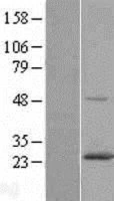 Western Blot RAB6A Overexpression Lysate