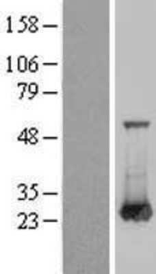 Western Blot RAB6A Overexpression Lysate