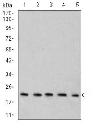Western Blot: RAB6B Antibody (6D12G9) [NBP2-61824] - Analysis using Rab6b mouse mAb against C6 (1), SK-N-SH (2), HT-29 (3), PC-12 (4), and C6 (5) cell lysate.