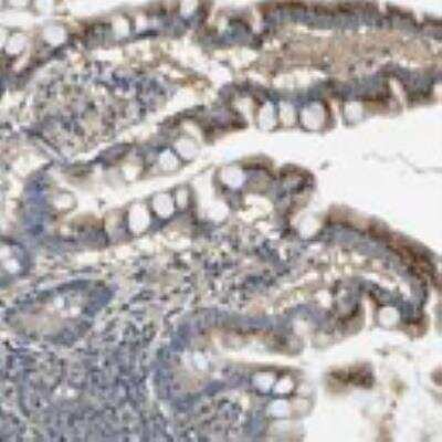 Immunohistochemistry: RAB6B Antibody [24320002] - Most normal tissue showed weak to moderate cytoplasmic and occasional membranous positivity. Parts of the gastrointestinal tract and Purkinje cells were strongly stained. Malignant cells were in most cases weakly stained or negative. Malignant gliomas and fractions of the malignant melanomas, renal and testicular cancers showed moderate positivity.  Image and statement courtesy of the Human Protein Atlas (HPA).