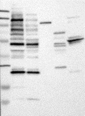 Western Blot: RAB6B Antibody [24320002] - Samples: Lane 1, Marker [kDa]: 250, 130, 95, 72, 55, 36, 28, 17, 11  Lane 2, RT-4  Lane 3, U-251MG sp Lane 4, Human Plasma  Lane 5, Liver  Lane 6, Tonsil ,  Target weight [kDa]: 23  Validation score: 2   Validation description: Supportive - Band of predicted size in kDa (+/-20%) with additional bands present.