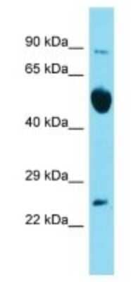 Western Blot: RAB6B Antibody [NBP3-09488] - Western blot analysis of RAB6B in Mouse Brain lysates. Antibody dilution at 1.0ug/ml
