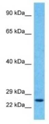 Western Blot: RAB6B Antibody [NBP3-09950] - Western blot analysis of RAB6B in HepG2 Whole Cell lysates. Antibody dilution at 1.0ug/ml