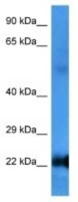 Western Blot: RAB6B Antibody [NBP3-10008] - Western blot analysis of RAB6B in Human Hela Whole Cell. Antibody dilution at 1.0ug/ml