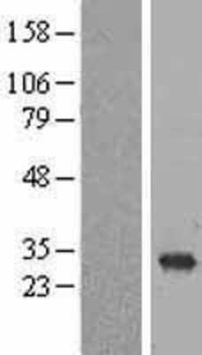 Western Blot: RAB6B Overexpression Lysate (Adult Normal) [NBL1-15085] Left-Empty vector transfected control cell lysate (HEK293 cell lysate); Right -Over-expression Lysate for RAB6B.