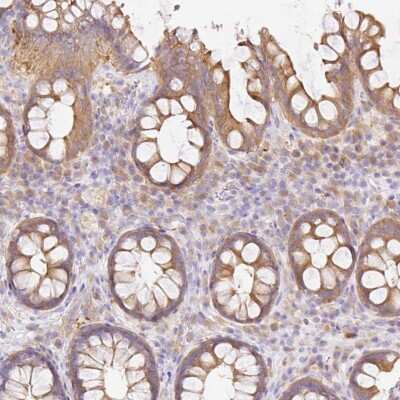 Immunohistochemistry-Paraffin RAB6IP1 Antibody