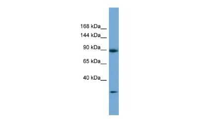 Western Blot: RAB6IP1 Antibody [NBP2-88118] - Host: Rabbit. Target Name: DENND5A. Sample Type: 721_B Whole cell lysates. Antibody Dilution: 1.0ug/ml