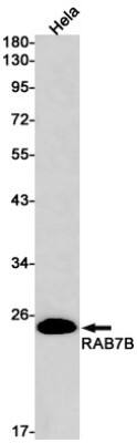 Western Blot: RAB7B Antibody (S08-2C5) [NBP3-19754] - Western blot detection of RAB7B in Hela cell lysates using NBP3-19754 (1:1000 diluted). Predicted band size: 23kDa. Observed band size: 23kDa.