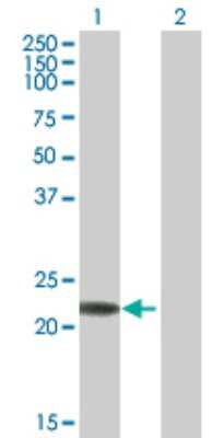 Western Blot: RAB7B Antibody [H00338382-B01P] - Analysis of RAB7B expression in transfected 293T cell line by RAB7B polyclonal antibody.  Lane 1: RAB7B transfected lysate(21.89 KDa). Lane 2: Non-transfected lysate.