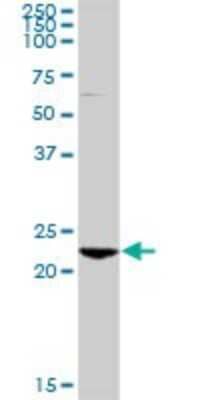 Western Blot RAB7B Antibody