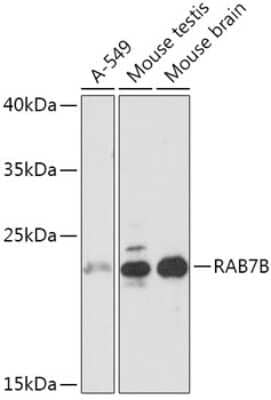 Western Blot: RAB7B Antibody [NBP2-94435] - Analysis of extracts of various cell lines, using RAB7B at 1:1000 dilution. Secondary antibody: HRP Goat Anti-Rabbit IgG (H+L) at 1:10000 dilution. Lysates/proteins: 25ug per lane. Blocking buffer: 3% nonfat dry milk in TBST. Detection: ECL Basic Kit . Exposure time: 3s.