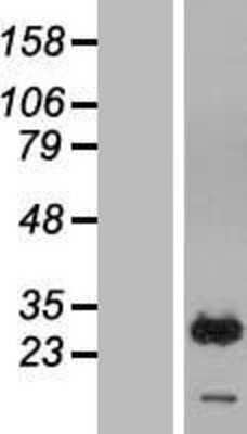 Western Blot RAB7B Overexpression Lysate