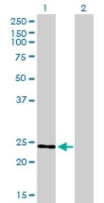 Western Blot: RAB7L1 Antibody (2B8) [H00008934-M03] - Analysis of RAB7L1 expression in transfected 293T cell line by RAB7L1 monoclonal antibody (M03), clone 2B8. Lane 1: RAB7L1 transfected lysatE (23.2 KDa). Lane 2: Non-transfected lysate.