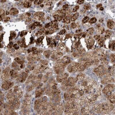 Immunohistochemistry-Paraffin RAB7L1 Antibody