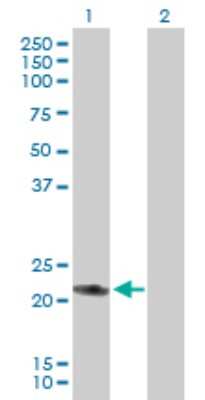 Western Blot: RAB7L1 Antibody [H00008934-B01P] - Analysis of RAB7L1 expression in transfected 293T cell line by RAB7L1 polyclonal antibody.  Lane 1: RAB7L1 transfected lysate(22.33 KDa). Lane 2: Non-transfected lysate.