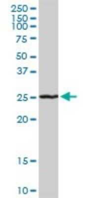 Western Blot: RAB7L1 Antibody [H00008934-D01P] - Analysis of RAB7L1 expression in mouse liver.