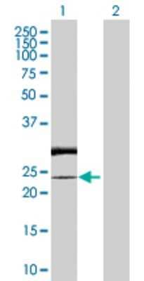 Western Blot: RAB7L1 Antibody [H00008934-D01P] - Analysis of RAB7L1 expression in transfected 293T cell line by RAB7L1 polyclonal antibody.Lane 1: RAB7L1 transfected lysate(23.20 KDa).Lane 2: Non-transfected lysate.