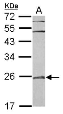 Western Blot: RAB7L1 Antibody [NBP2-20046] - Sample (30 ug of whole cell lysate) A: A431 12% SDS PAGE gel, diluted at 1:500.