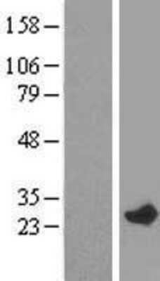 Western Blot RAB7L1 Overexpression Lysate