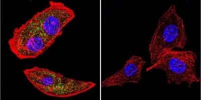 Immunocytochemistry/Immunofluorescence: RAB9A Antibody (Mab9) [NB300-621] - Analysis of RAB9 using RAB9 Monoclonal Antibody (Mab9) shows staining in U251 Cells. RAB9 (green), F-Actin staining with Phalloidin (red) and nuclei with DAPI (blue) is shown. Cells were grown on chamber slides and fixed with formaldehyde prior to staining. Cells were probed without (control) or with an antibody recognizing RAB9 at a dilution of 1:100 over night at 4C, washed with PBS and incubated with a DyLight-488 conjugated.