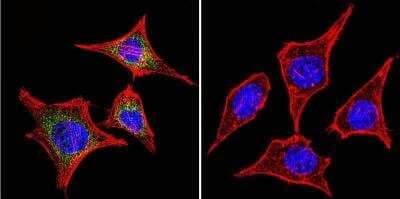 Immunocytochemistry/Immunofluorescence: RAB9A Antibody (Mab9) [NB300-621] - Analysis of RAB9 using RAB9 Monoclonal Antibody (Mab9) shows staining in Hela Cells. RAB9 (green), F-Actin staining with Phalloidin (red) and nuclei with DAPI (blue) is shown. Cells were grown on chamber slides and fixed with formaldehyde prior to staining. Cells were probed without (control) or with an antibody recognizing RAB9 at a dilution of 1:200 over night at 4C, washed with PBS and incubated with a DyLight-488 conjugated.