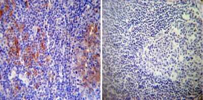 Immunohistochemistry-Paraffin: RAB9A Antibody (Mab9) [NB300-621] - Both normal and cancer biopsies of deparaffinized Human tonsil tissues.