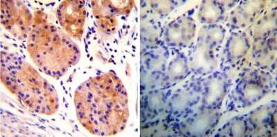 Immunohistochemistry-Paraffin: RAB9A Antibody (Mab9) [NB300-621] - Both normal and cancer biopsies of deparaffinized Human stomach tissues.