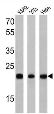 Western Blot: RAB9A Antibody (Mab9) [NB300-621] - Analysis of 25 ug of K562 (lane 1), 293 (lane 2) and Hela (lane 3).