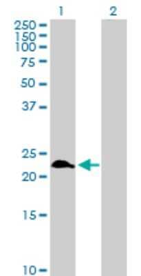 Western Blot: RAB9A Antibody [H00009367-D01P] - Analysis of RAB9A expression in transfected 293T cell line by RAB9A polyclonal antibody.Lane 1: RAB9A transfected lysate(22.80 KDa).Lane 2: Non-transfected lysate.