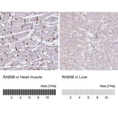 Immunohistochemistry-Paraffin RAB9B Antibody - BSA Free