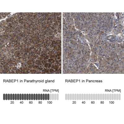 Immunohistochemistry-Paraffin: RABEP1 Antibody [NBP1-82590] - Staining in human parathyroid gland and pancreas tissues using anti-RABEP1 antibody. Corresponding RABEP1 RNA-seq data are presented for the same tissues.