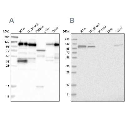 Western Blot: RABEP1 Antibody [NBP1-82590] - Analysis using Anti-RABEP1 antibody NBP1-82590 (A) shows similar pattern to independent antibody NBP1-82588 (B).