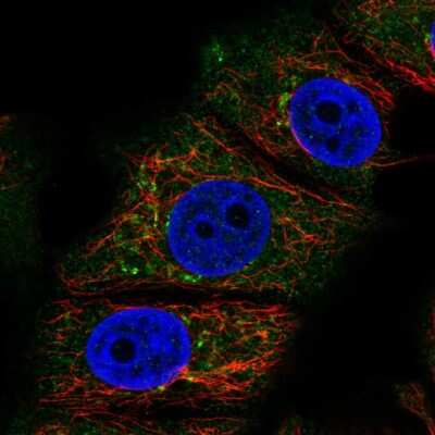 Immunocytochemistry/Immunofluorescence: RABEP2 Antibody [NBP2-13195] - Staining of human cell line MCF7 shows localization to cytosol & vesicles. Antibody staining is shown in green.